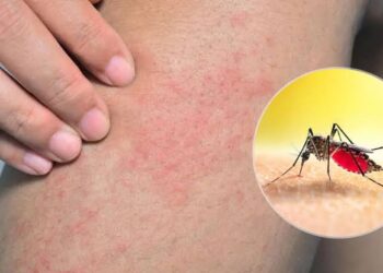 लखनऊ में लगातार बढ़ रहा डेंगू का कहर, मरीजों की संख्या हजारों के पार