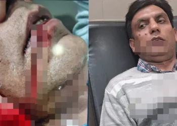 नहीं थम रहा चाइनीज मांझे का कहर, रिटायर्ड सैन्यकर्मी की चेहरा कटा.. राहगीरों ने पहुंचाया अस्पताल
