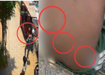 ढाई साल के मासूम को टॉफी का लालच देकर सगे मौसा ने जलती बीड़ी से दागा चेहरा